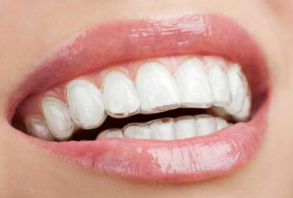 Causas maloclusión dental - Belén Pérez, dentista en Getxo