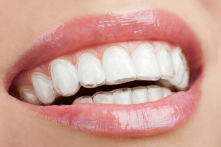 Causas maloclusión dental - Belén Pérez, dentista en Getxo