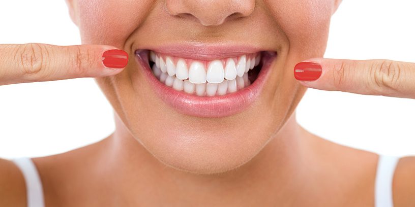Cómo prevenir las caries para conseguir una sonrisa bonita.