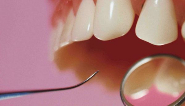 Uso del composite dental