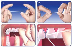 importancia usar hilo dental - Belén Perez dental