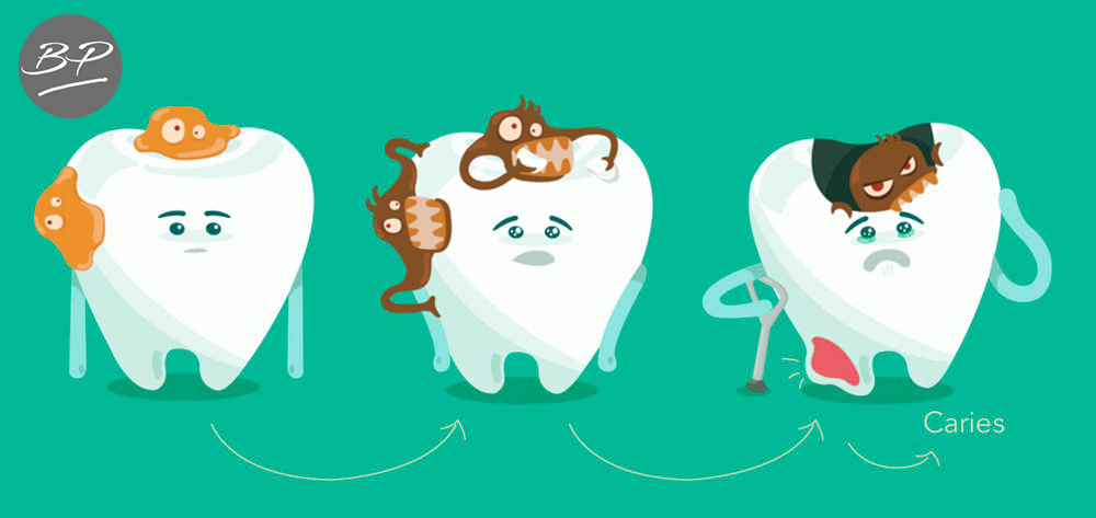 caries fases