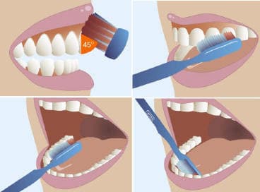 cómo cepillarte los dientes correctamente