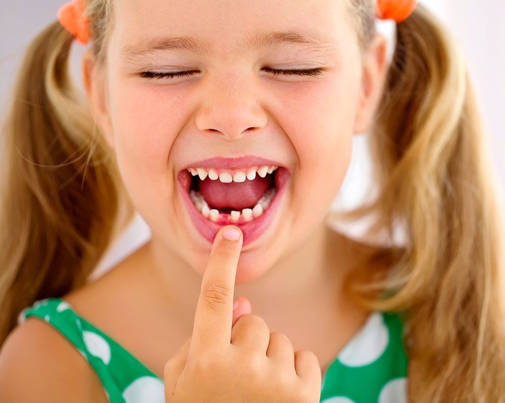 dientes de leche