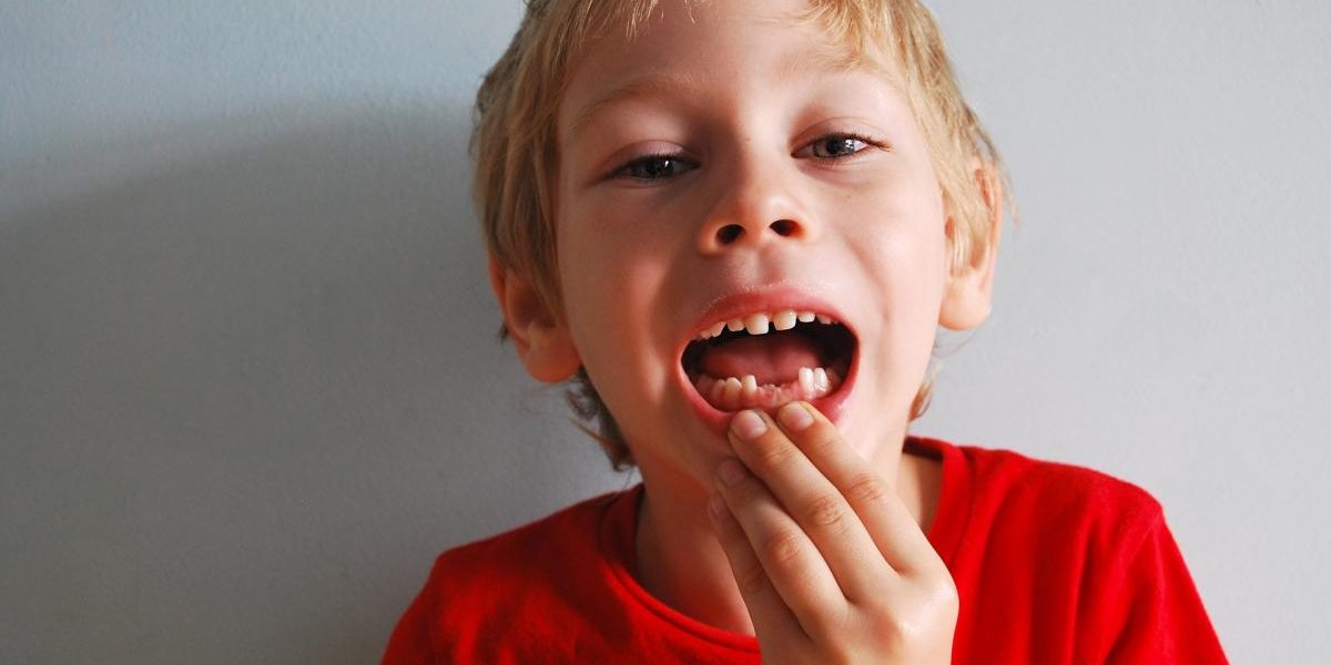 traumatismo dental, qué es
