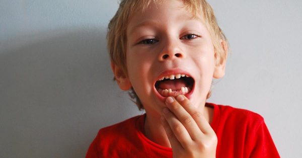 traumatismo dental, qué es