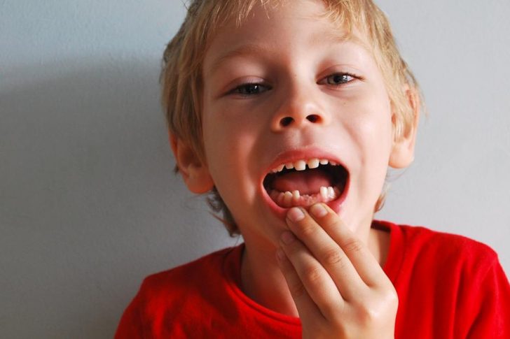 traumatismo dental, qué es
