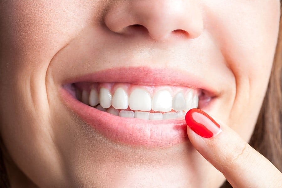 a qué se deben los dientes oscurecidos