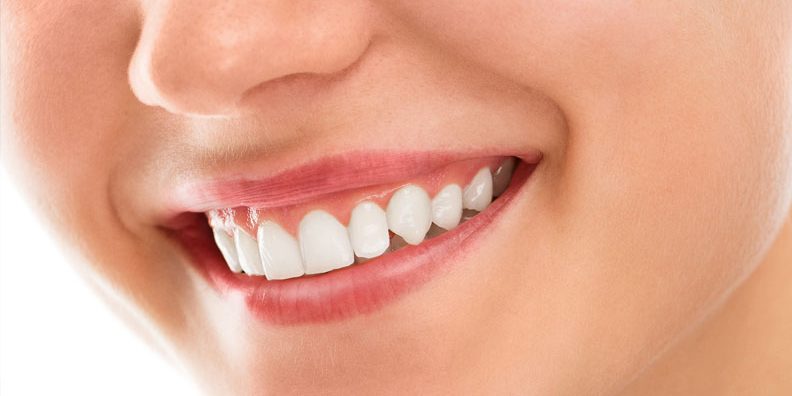 qué es la gingivitis - Gingivectomía