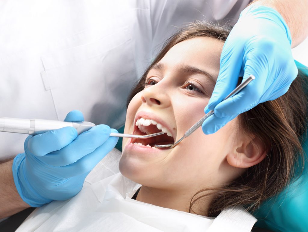 selladores dentales para niños - Clinica Belen Perez