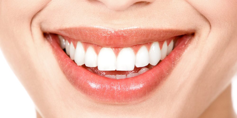 Todo lo que tienes que saber sobre el blanqueamiento dental