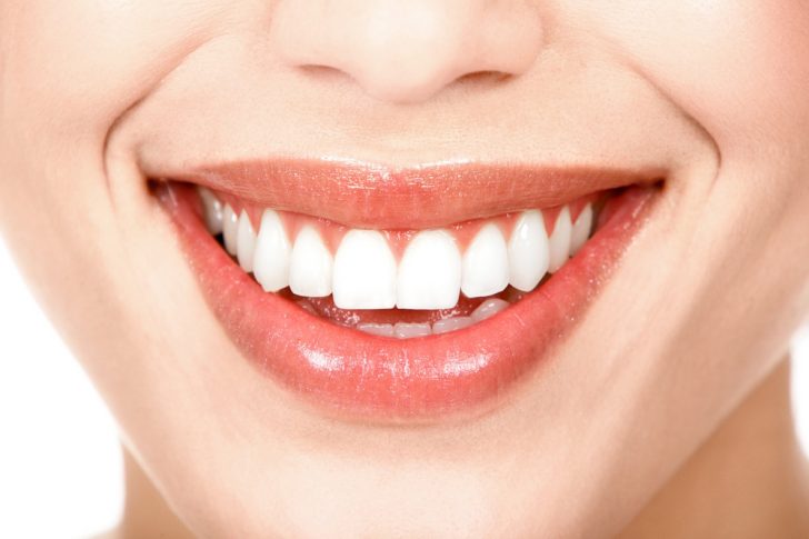 Todo lo que tienes que saber sobre el blanqueamiento dental