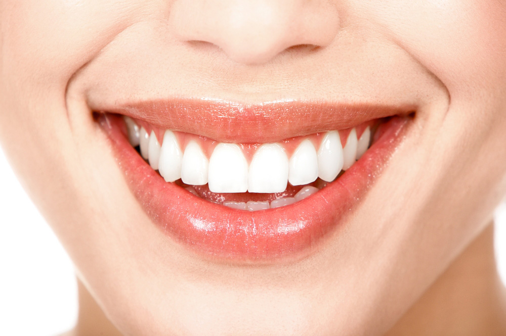 Todo lo que tienes que saber sobre el blanqueamiento dental