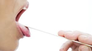 leucoplasia oral revisión