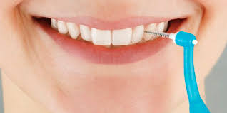 limpieza interdental
