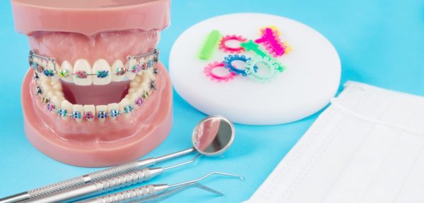 tipos de brackets y de ortodoncia