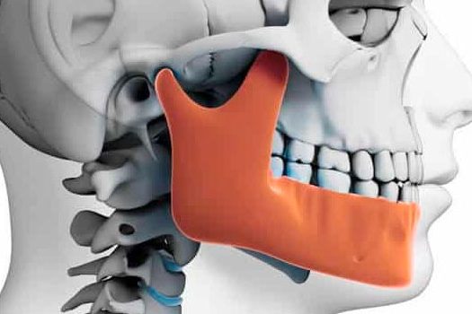 Trastorno de la articulación temporomandibular