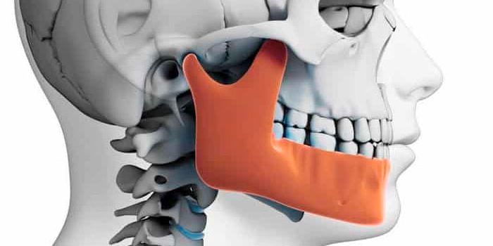 Trastorno de la articulación temporomandibular