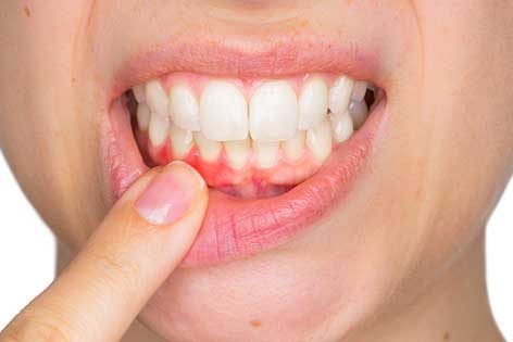Salud bucodental