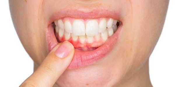 Salud bucodental