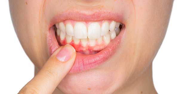 Salud bucodental