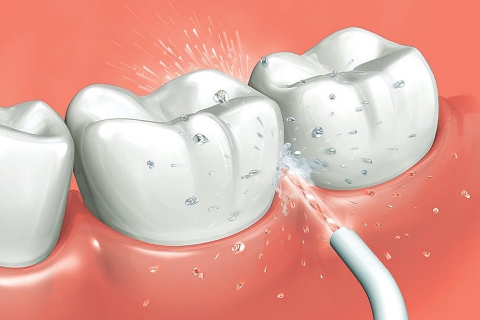 Dientes e irrigador dental
