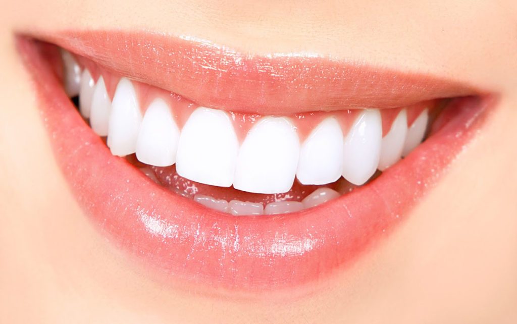 Blanqueamiento dental en casa - Clínica Dental en Getxo Belén Pérez
