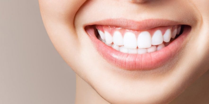 Como hacer un blanqueamiento dental casero - Clínica dental Belén Pérez