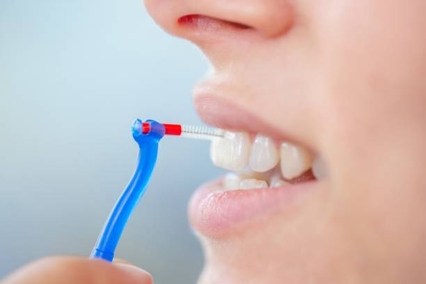 cepillo interproximal
