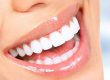 estética dental