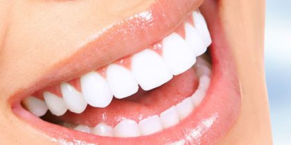 estética dental
