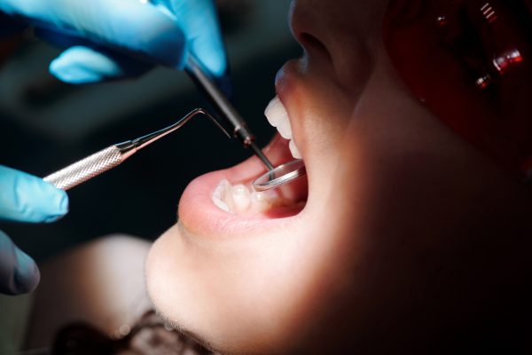 Importancia de visitar al dentista una vez al año