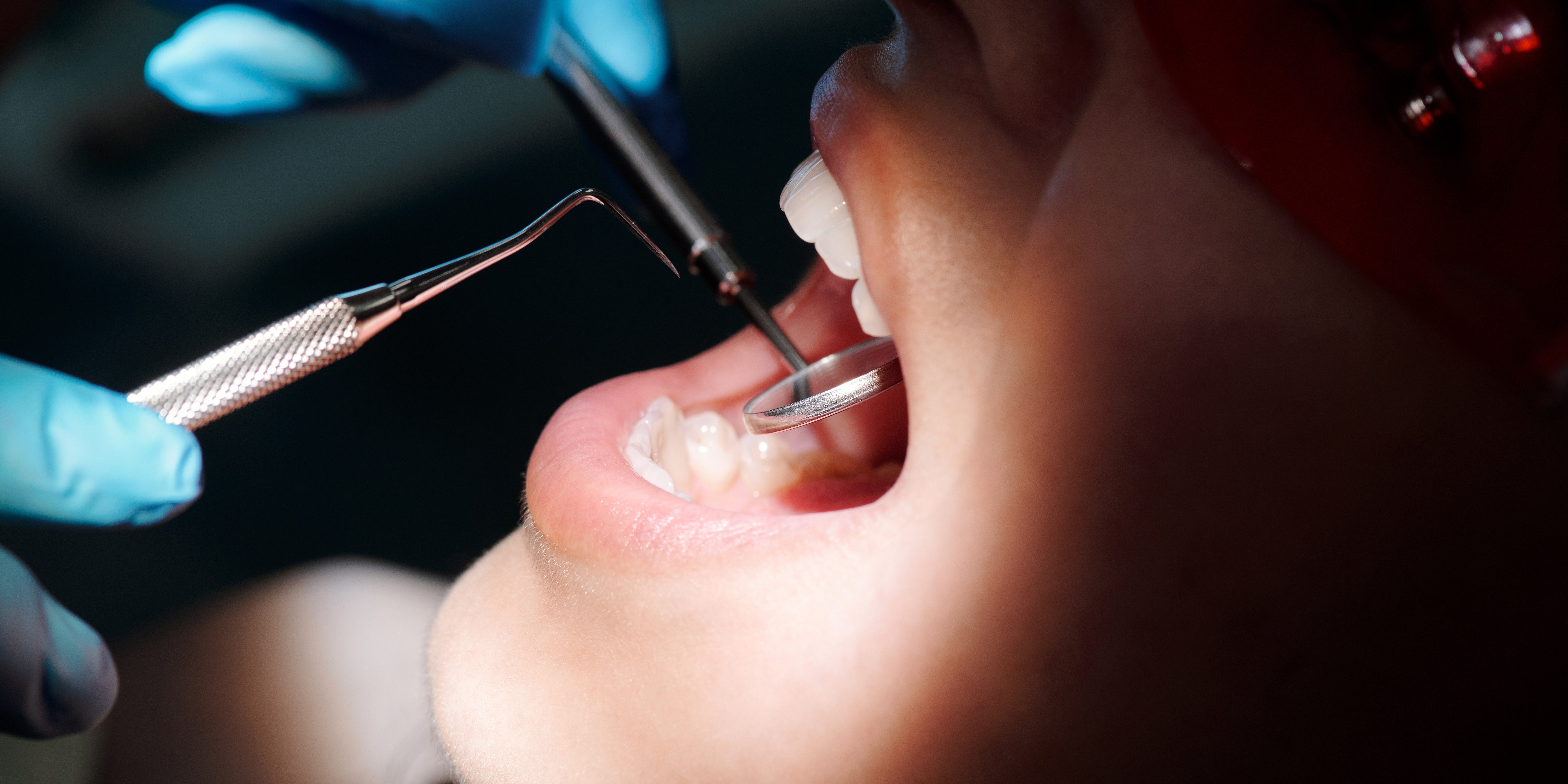 Importancia de visitar al dentista una vez al año