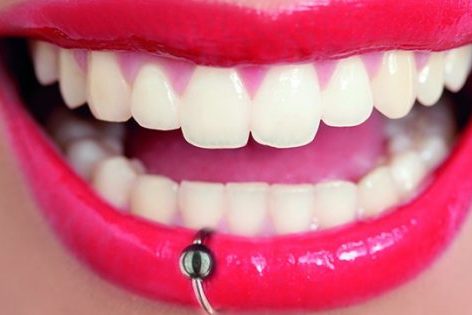 Piercings. ¿Qué daños provocan en tu boca?