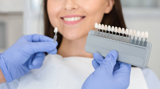 se puede tratar la hipoplasia dental grave con un implante