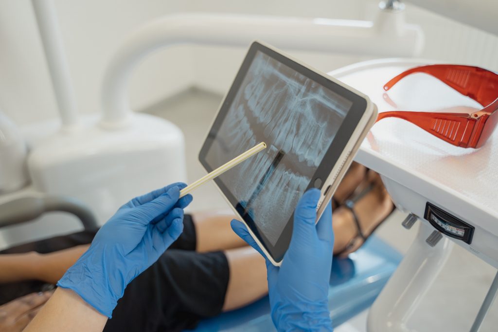 Protocolo Obturación dental