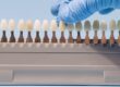 Diferentes tonalidades de los dientes