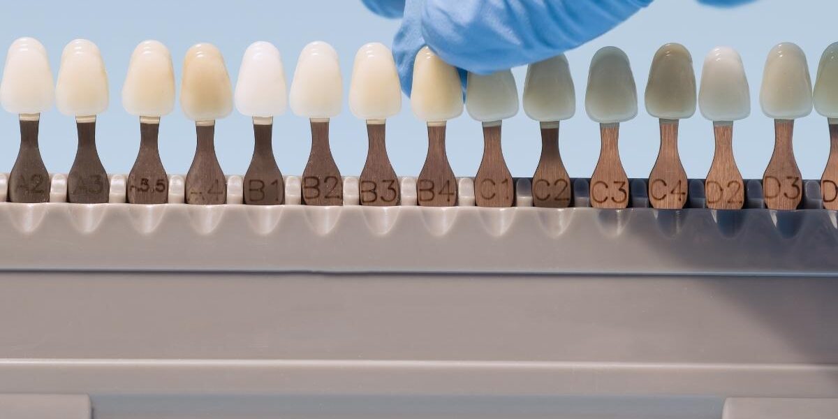 Diferentes tonalidades de los dientes