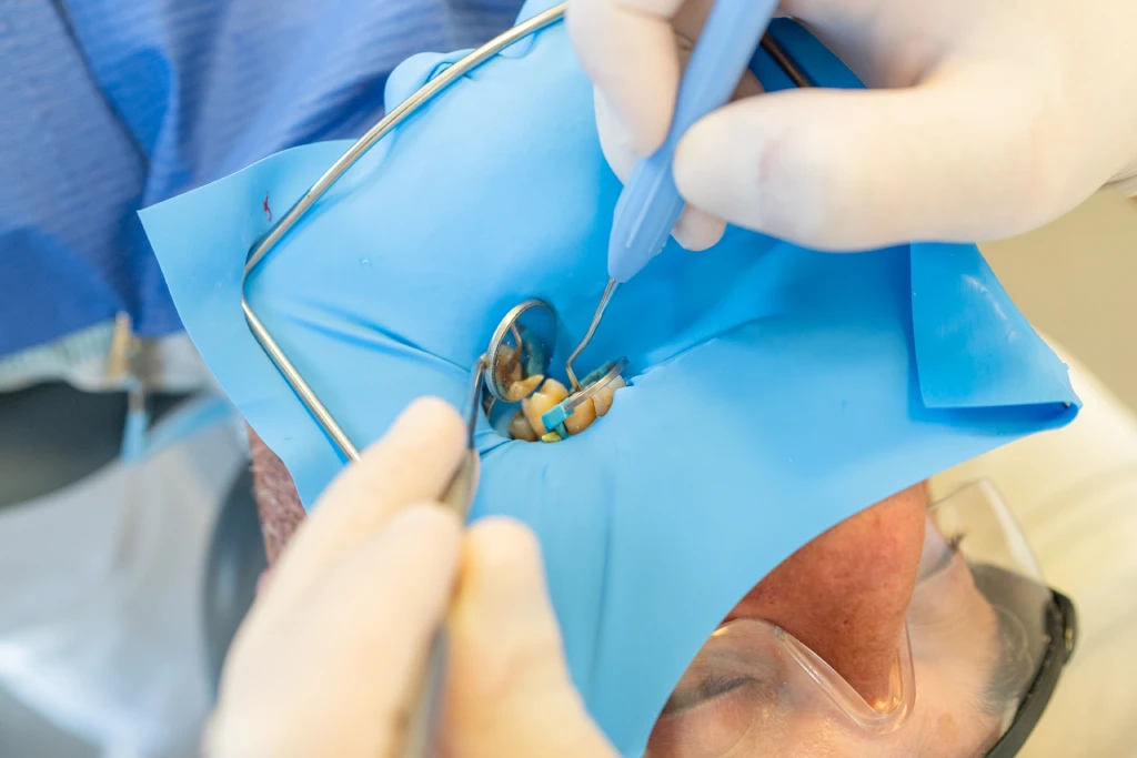 Endodoncia con aislamiento absoluto (dique de goma) en la clínica de Getxo